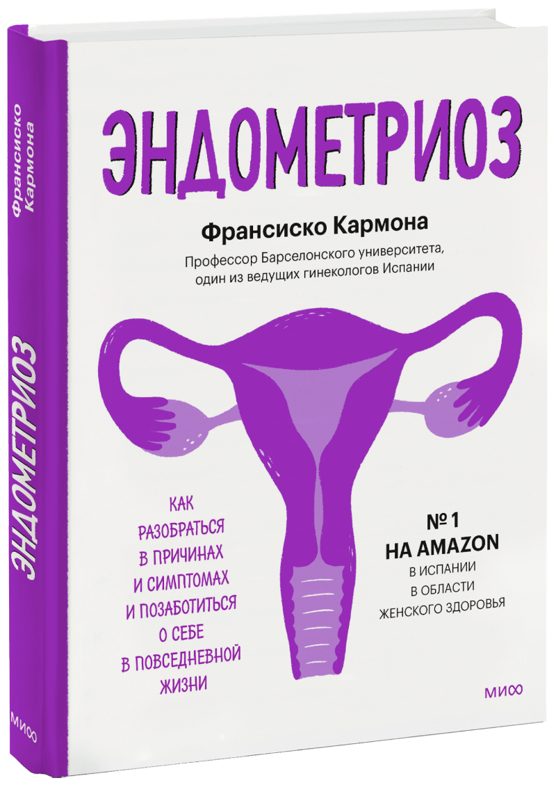 Эндометриоз (Франсиско Кармона) — купить в МИФе